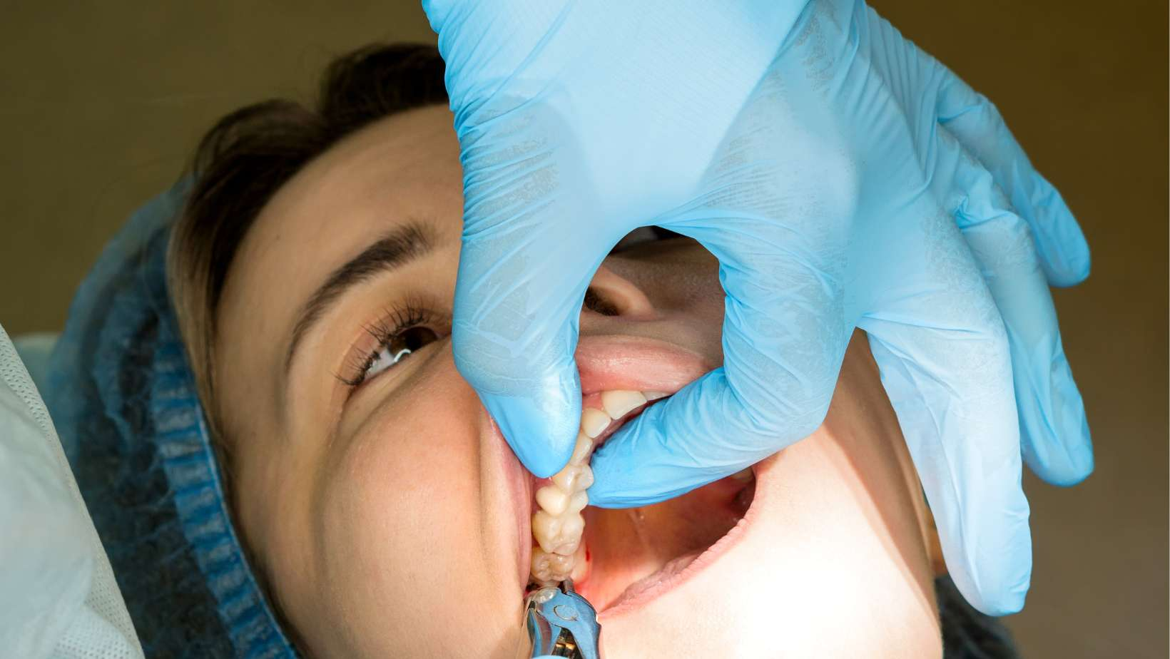 better teeth